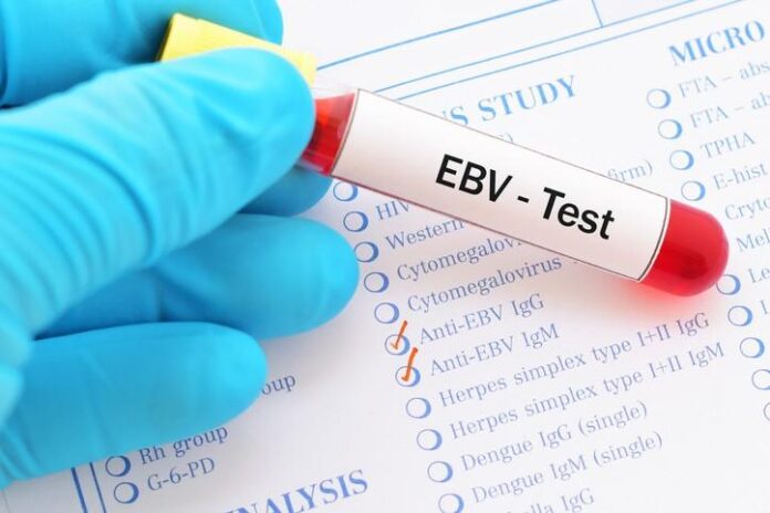 Virus-Epstein-Barr.jpg