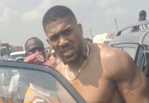 Ο Άντονι Τζόσουα βγήκε από το νοσοκομείο μετά το τροχαίο δυστύχημα