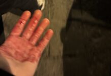 Μαχαίρωσαν δύο οπαδούς της Τσέλσι πριν το παιχνίδι με τη Νάπολι