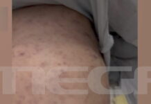 Σε αναστολή η παιδίατρος για την υπόθεση του βρέφους που νοσηλεύεται με μηνιγγίτιδα σε ΜΕΘ στην Πάτρα